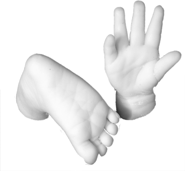 Hand Cast Example 1